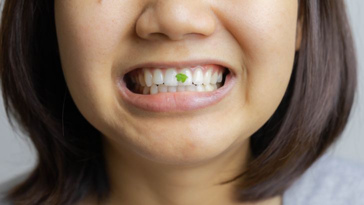 Spinach stuck in their teeth